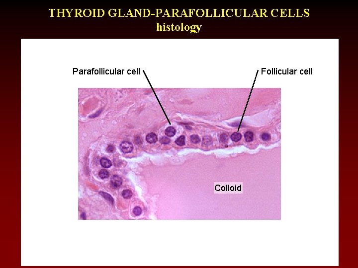 THYROID GLAND-PARAFOLLICULAR CELLS histology Parafollicular cell Follicular cell Colloid 
