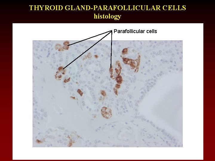 THYROID GLAND-PARAFOLLICULAR CELLS histology Parafollicular cells 