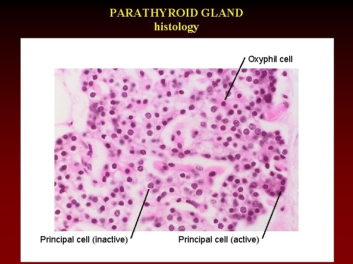 PARATHYROID GLAND histology Oxyphil cell Principal cell (inactive) Principal cell (active) 