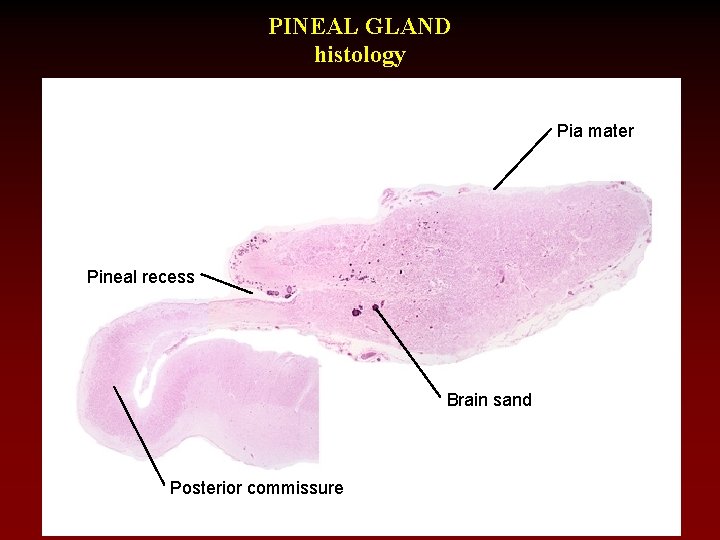 PINEAL GLAND histology Pia mater Pineal recess Brain sand Posterior commissure 