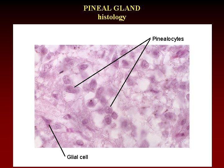 PINEAL GLAND histology Pinealocytes Glial cell 
