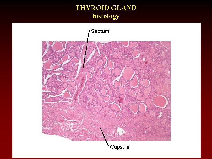 THYROID GLAND histology Septum Capsule 