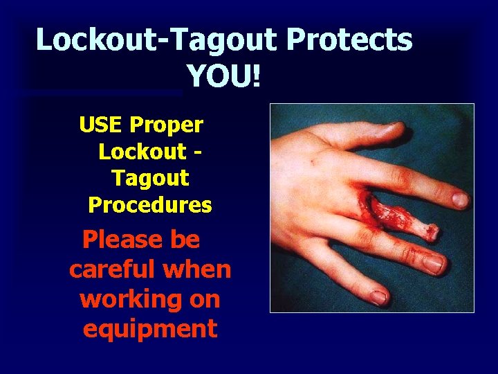 Lockout-Tagout Protects YOU! USE Proper Lockout - Tagout Procedures Please be careful when working