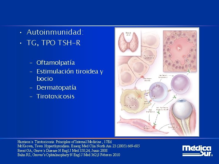  • Autoinmunidad: • TG, TPO TSH-R – Oftamolpatía – Estimulación tiroidea y bocio
