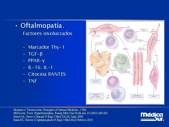  • Oftalmopatia. Factores involucrados – – – Marcador Thy-1 TGF-β PPAR-γ IL-16. IL-1