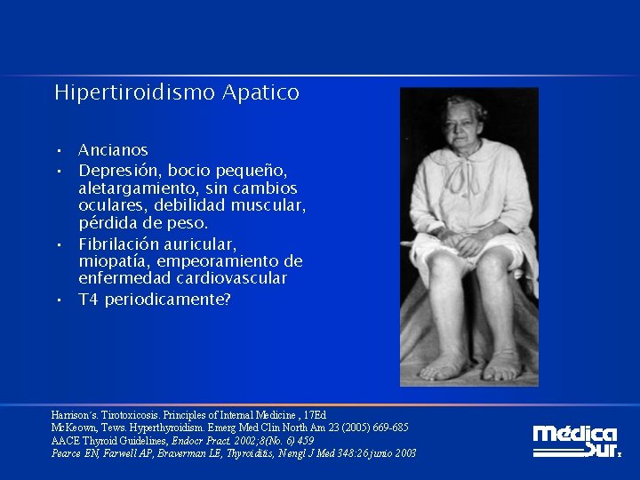 Hipertiroidismo Apatico • Ancianos • Depresión, bocio pequeño, aletargamiento, sin cambios oculares, debilidad muscular,