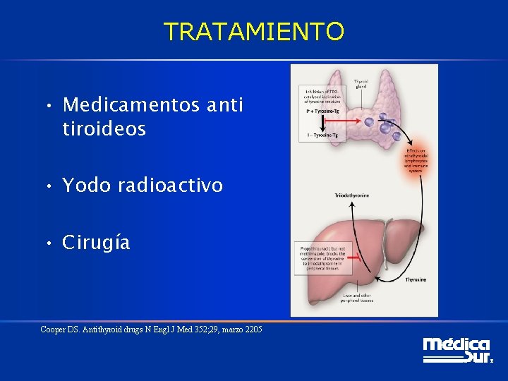 TRATAMIENTO • Medicamentos anti tiroideos • Yodo radioactivo • Cirugía Cooper DS. Antithyroid drugs