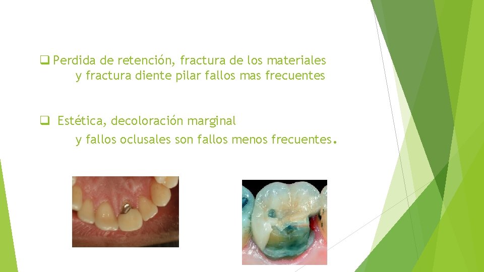 q Perdida de retención, fractura de los materiales y fractura diente pilar fallos mas