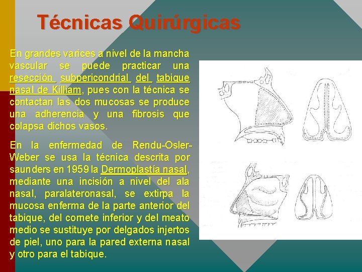 Técnicas Quirúrgicas En grandes varices a nivel de la mancha vascular se puede practicar