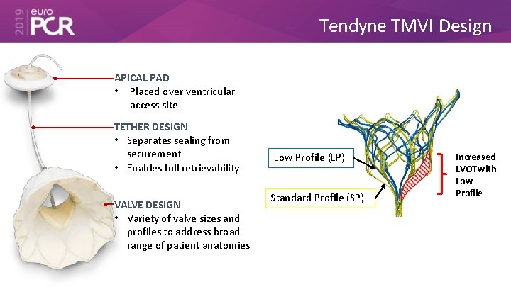 Tendyne TMVI Design APICAL PAD • Placed over ventricular access site TETHER DESIGN •