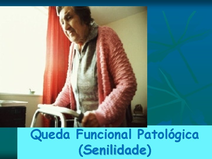Queda Funcional Patológica (Senilidade) Senilidade Queda Funcional Patológica (Senilidade) Senilidade