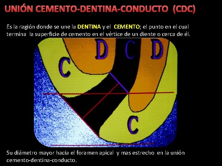 UNIÓN CEMENTO-DENTINA-CONDUCTO (CDC) Es la ragión donde se une la DENTINA y el CEMENTO;