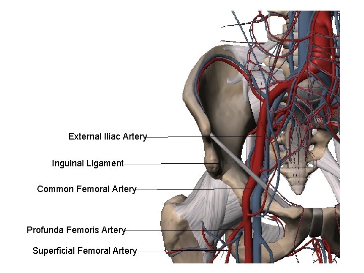 External Iliac Artery Inguinal Ligament Common Femoral Artery Profunda Femoris Artery Superficial Femoral Artery