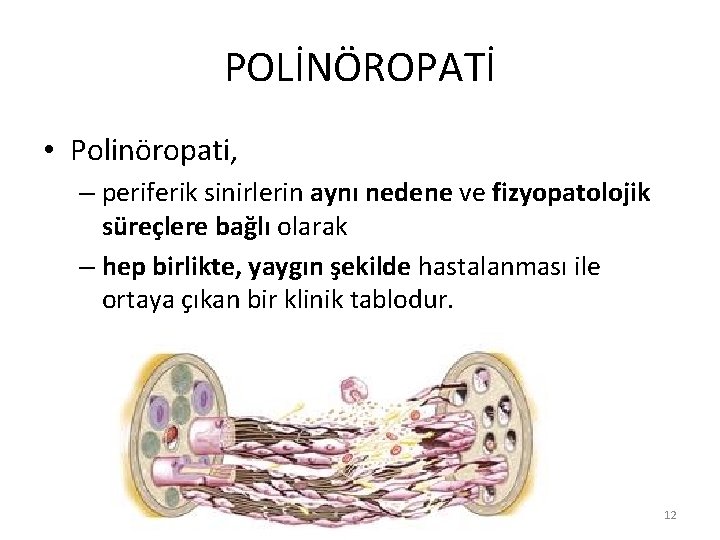 POLİNÖROPATİ • Polinöropati, – periferik sinirlerin aynı nedene ve fizyopatolojik süreçlere bağlı olarak –