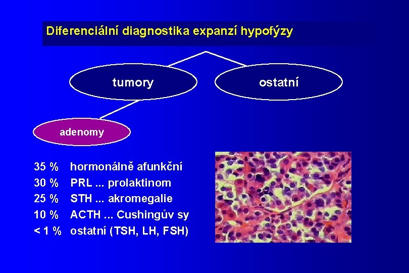 Diferenciální diagnostika expanzí hypofýzy tumory adenomy 35 % 30 % 25 % 10 %