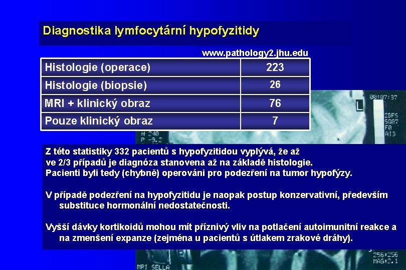 Diagnostika lymfocytární hypofyzitidy www. pathology 2. jhu. edu Histologie (operace) 223 Histologie (biopsie) 26