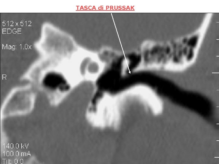 TASCA di PRUSSAK 