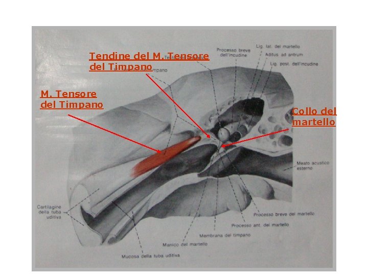 Tendine del M. Tensore del Timpano Collo del martello 