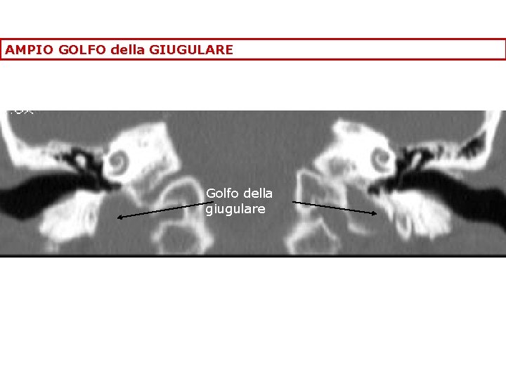 AMPIO GOLFO della GIUGULARE Golfo della giugulare 