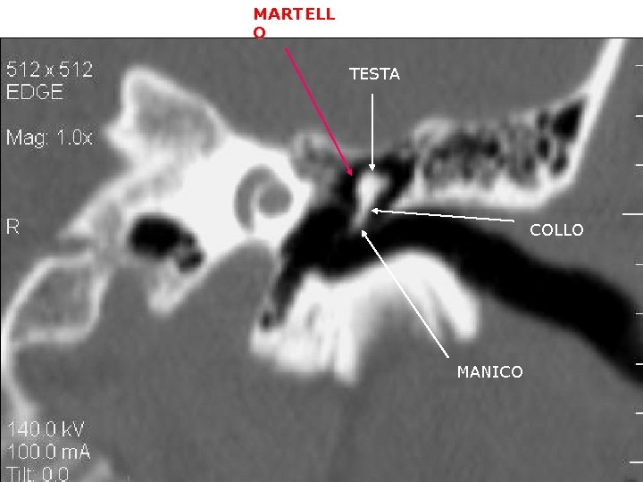 MARTELL O TESTA COLLO MANICO 