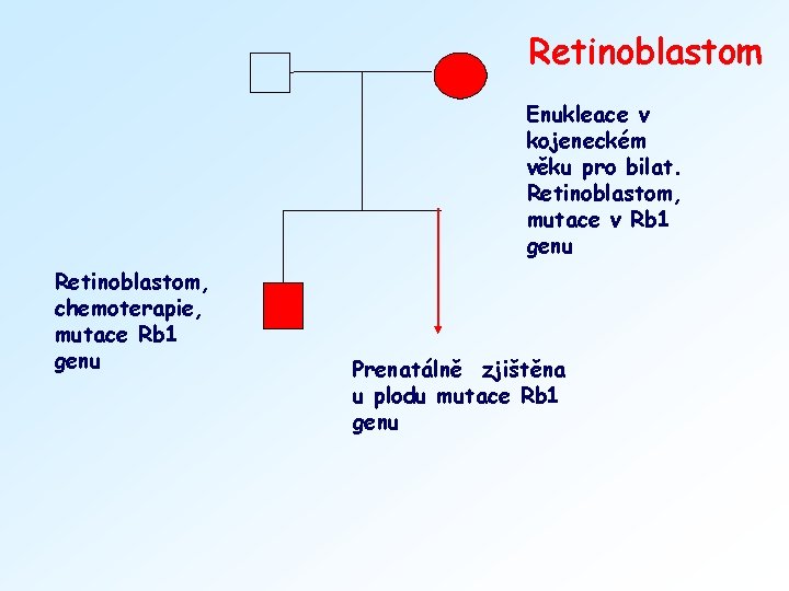 Retinoblastom Enukleace v kojeneckém věku pro bilat. Retinoblastom, mutace v Rb 1 genu Retinoblastom,