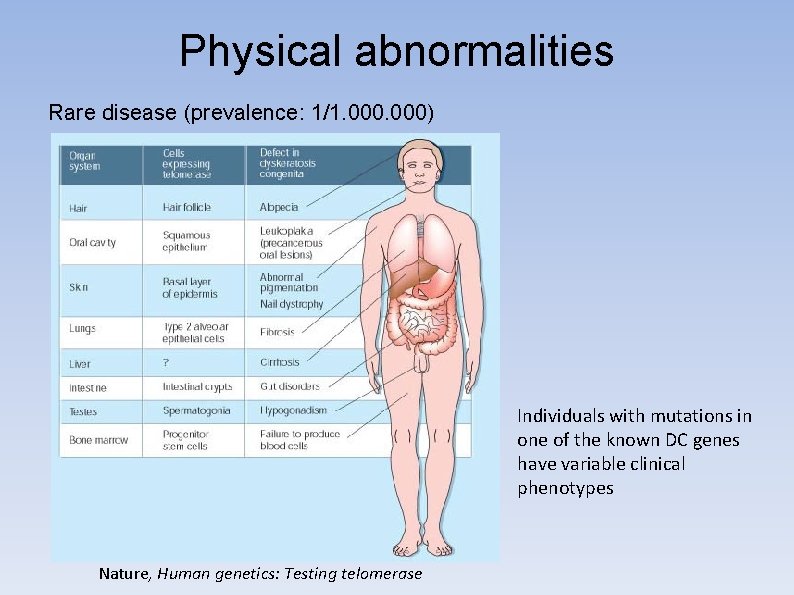Physical abnormalities Rare disease (prevalence: 1/1. 000) Individuals with mutations in one of the