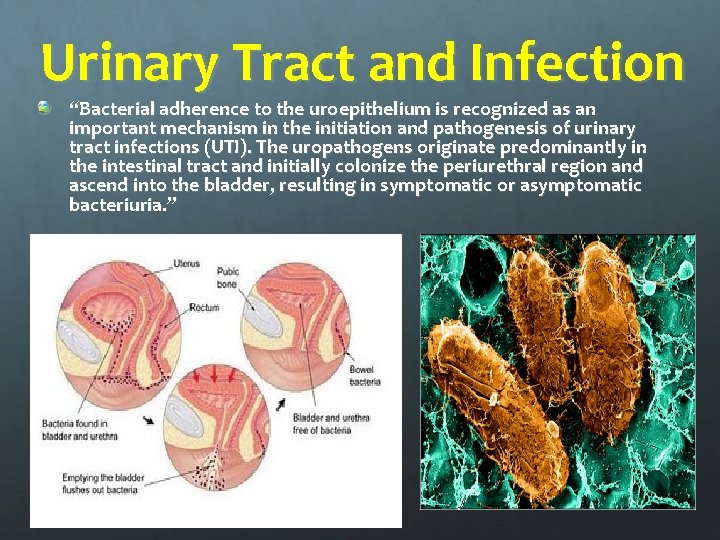 Urinary Tract and Infection “Bacterial adherence to the uroepithelium is recognized as an important