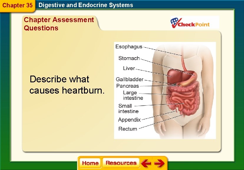 Chapter 35 Digestive and Endocrine Systems Chapter Assessment Questions Describe what causes heartburn. 