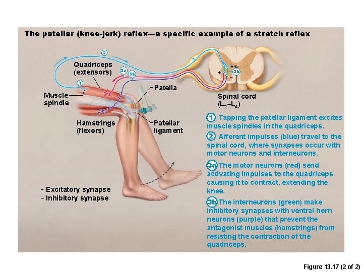 The patellar (knee-jerk) reflex—a specific example of a stretch reflex 2 Quadriceps (extensors) 1