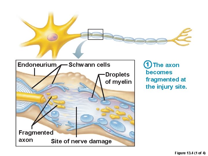 Endoneurium Schwann cells Droplets of myelin 1 The axon becomes fragmented at the injury