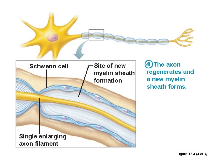 Schwann cell Site of new myelin sheath formation 4 The axon regenerates and a