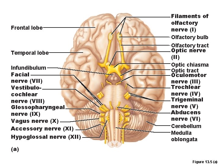 Frontal lobe Temporal lobe Infundibulum Facial nerve (VII) Vestibulocochlear nerve (VIII) Glossopharyngeal nerve (IX)