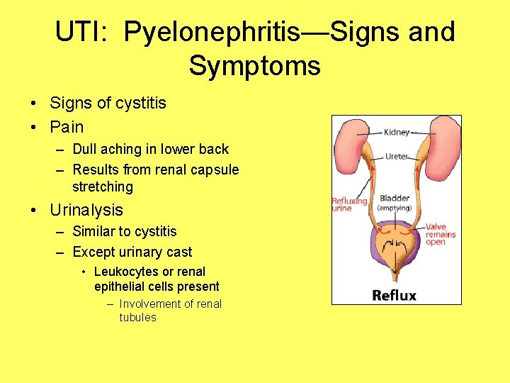 UTI: Pyelonephritis—Signs and Symptoms • Signs of cystitis • Pain – Dull aching in