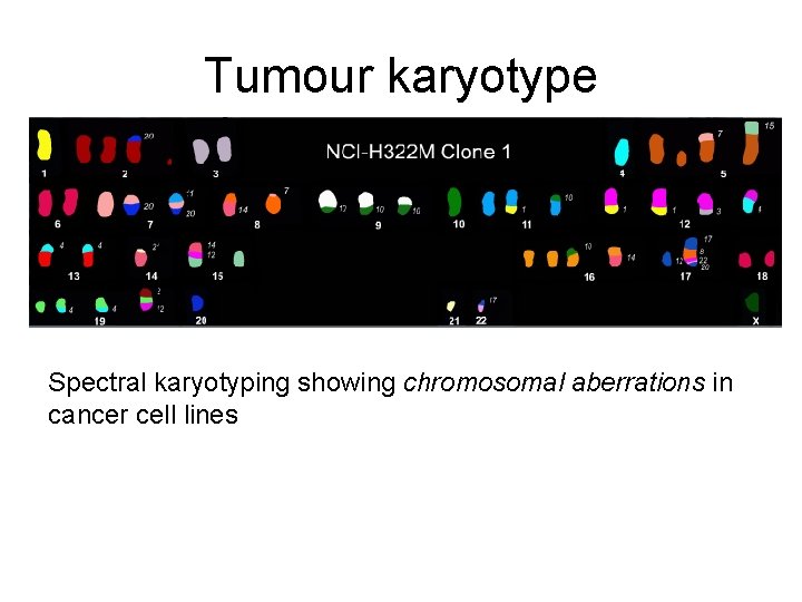 Tumour karyotype Spectral karyotyping showing chromosomal aberrations in cancer cell lines 