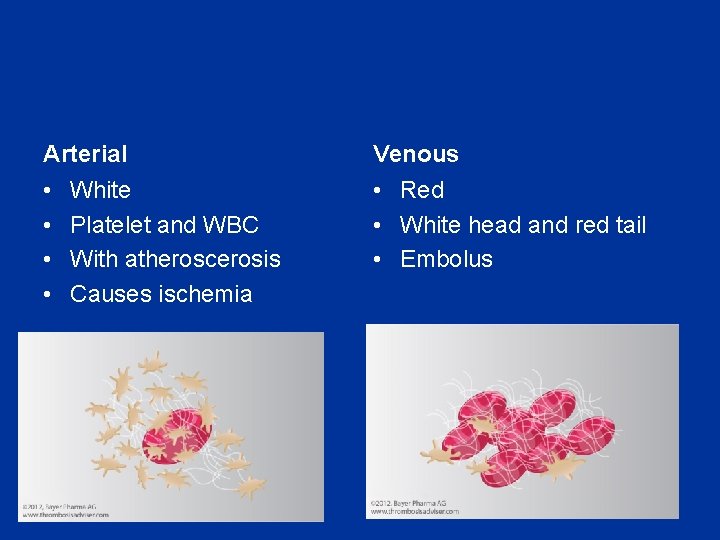 Arterial Venous • • • Red • White head and red tail • Embolus