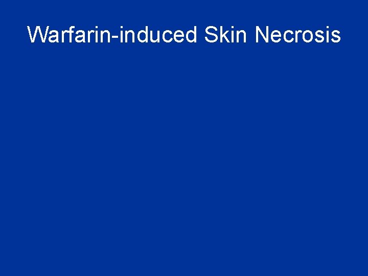 Warfarin-induced Skin Necrosis 