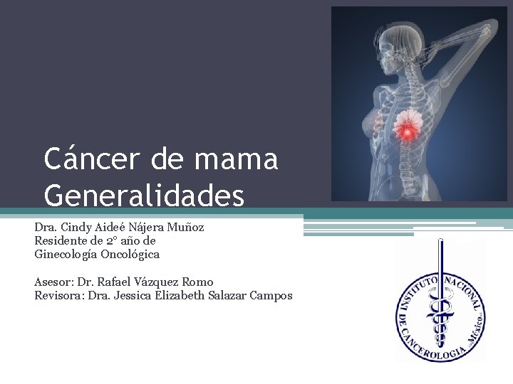 Cáncer de mama Generalidades Dra. Cindy Aideé Nájera Muñoz Residente de 2° año de