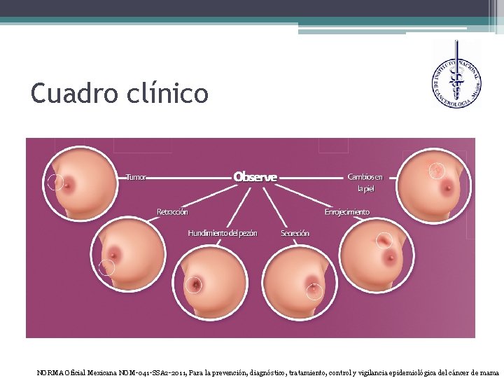 Cuadro clínico NORMA Oficial Mexicana NOM-041 -SSA 2 -2011, Para la prevención, diagnóstico, tratamiento,