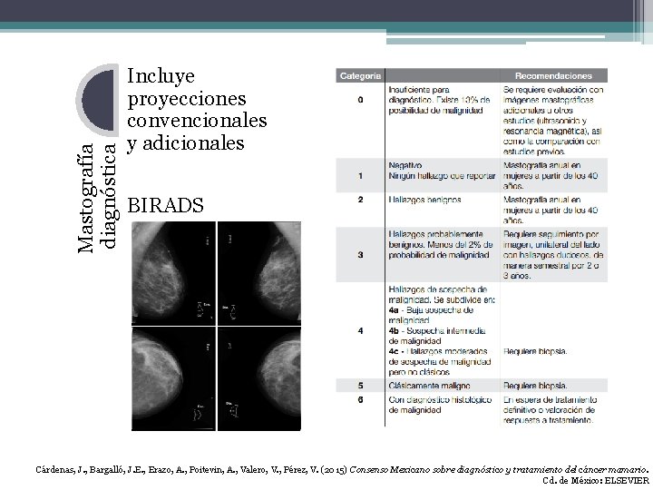 Mastografía diagnóstica Incluye proyecciones convencionales y adicionales BIRADS Cárdenas, J. , Bargalló, J. E.