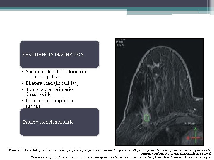 RESONANCIA MAGNÉTICA • Sospecha de inflamatorio con biopsia negativa • Bilateralidad (Lobulillar) • Tumor