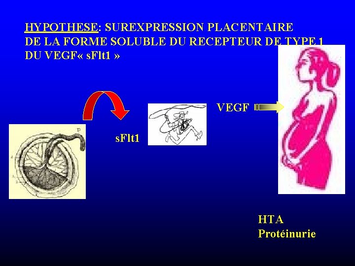 HYPOTHESE: SUREXPRESSION PLACENTAIRE DE LA FORME SOLUBLE DU RECEPTEUR DE TYPE 1 DU VEGF