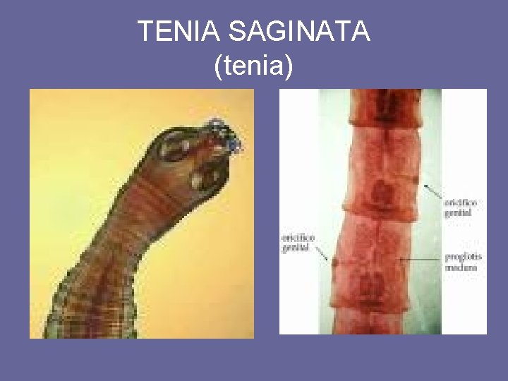 TENIA SAGINATA (tenia) 