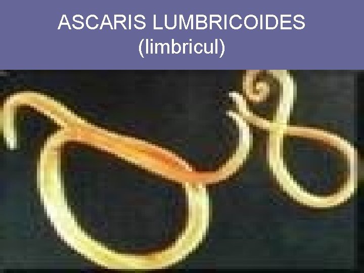 ASCARIS LUMBRICOIDES (limbricul) 