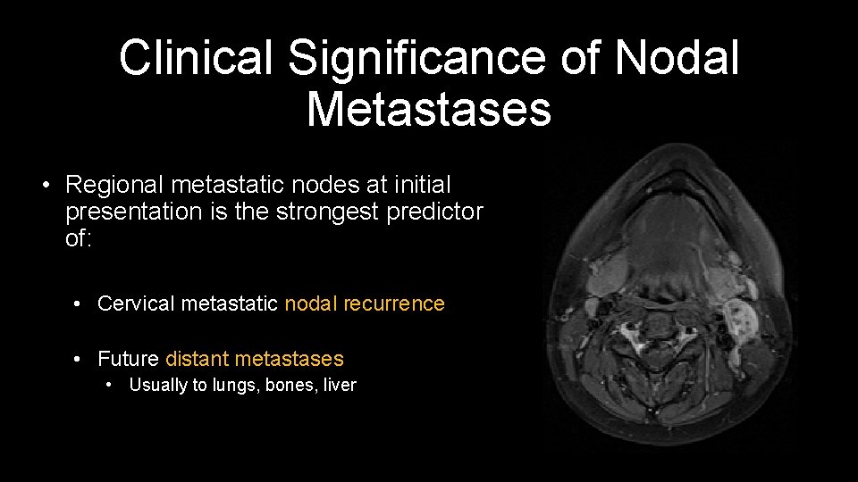 Clinical Significance of Nodal Metastases • Regional metastatic nodes at initial presentation is the