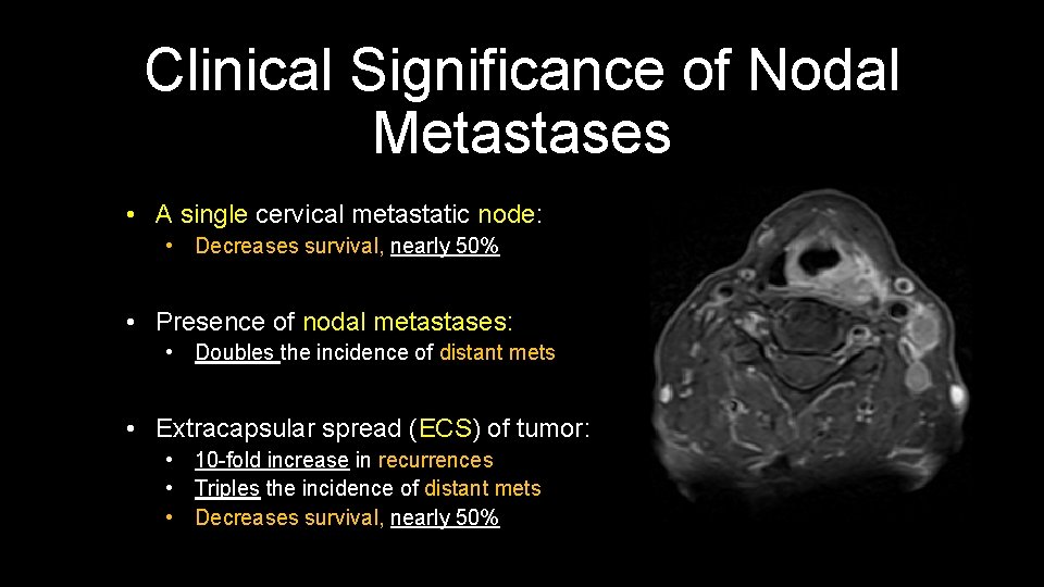 Clinical Significance of Nodal Metastases • A single cervical metastatic node: • Decreases survival,