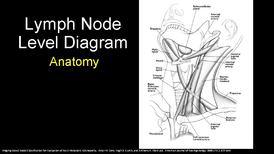 Lymph Node Level Diagram Anatomy Imaging-Based Nodal Classification for Evaluation of Neck Metastatic Adenopathy.