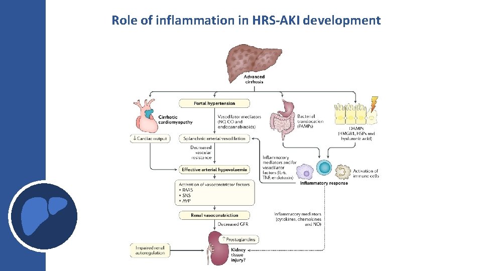 Role of inflammation in HRS-AKI development Role of inflammation in HRS-AKI development