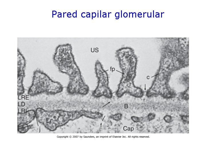 Pared capilar glomerular 