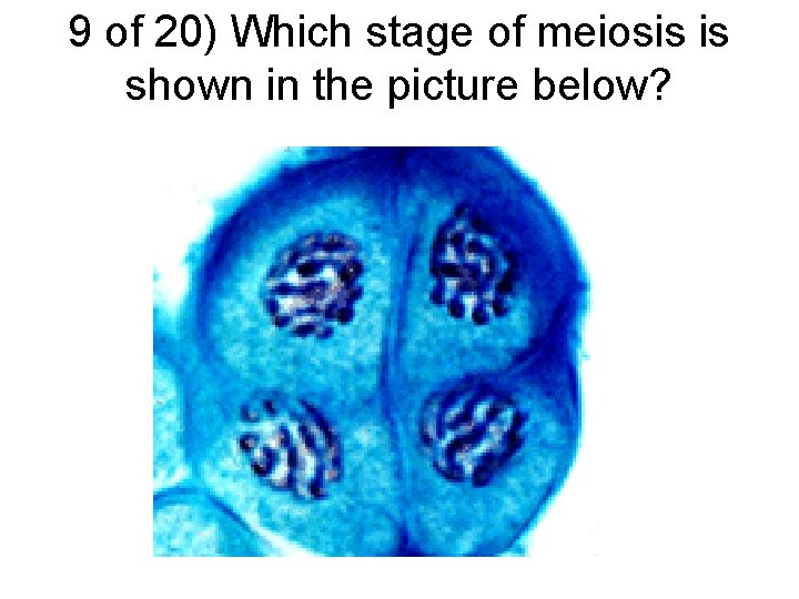 9 of 20) Which stage of meiosis is shown in the picture below? 