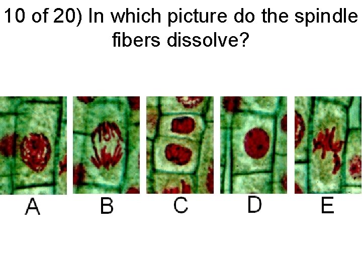 10 of 20) In which picture do the spindle fibers dissolve? 